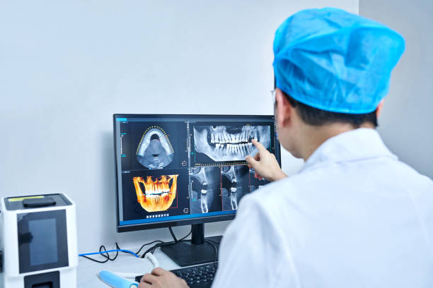 Best Emergency Root Canal Treatment in Westwood Lakes, FL
